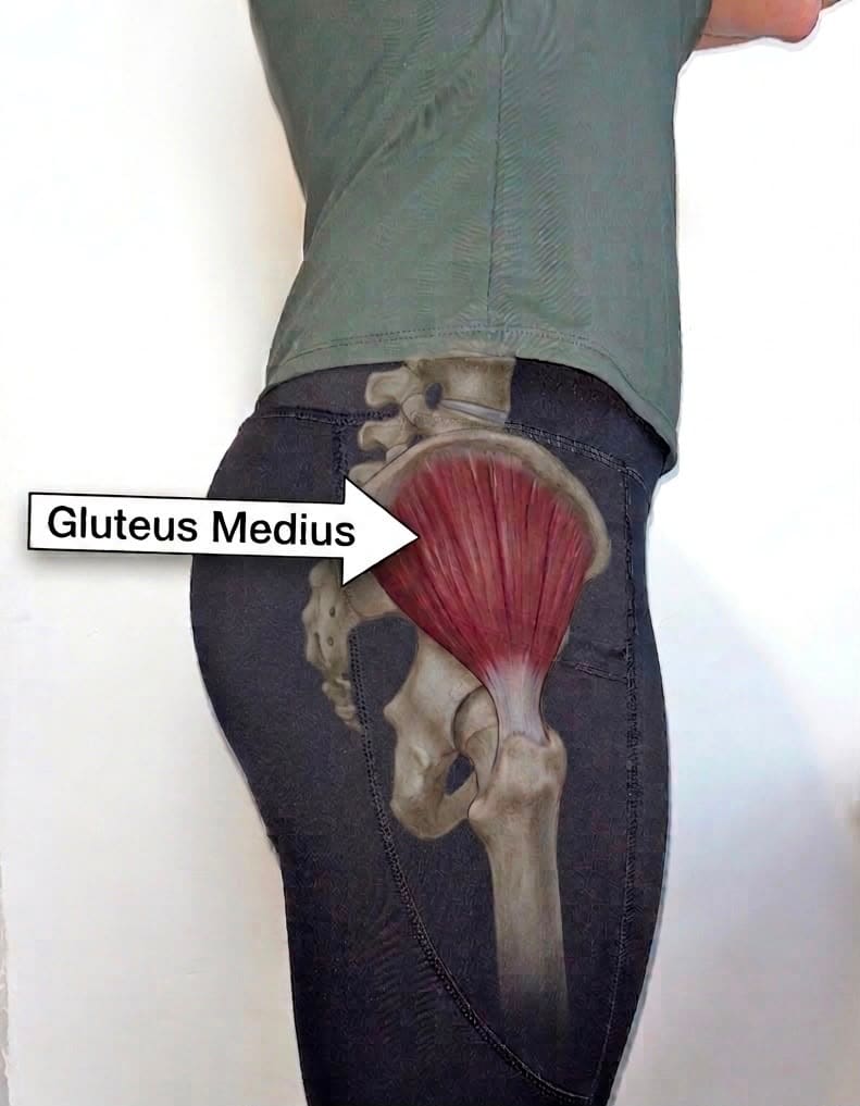 Hannah's hip with the gluteus medius location superimposed